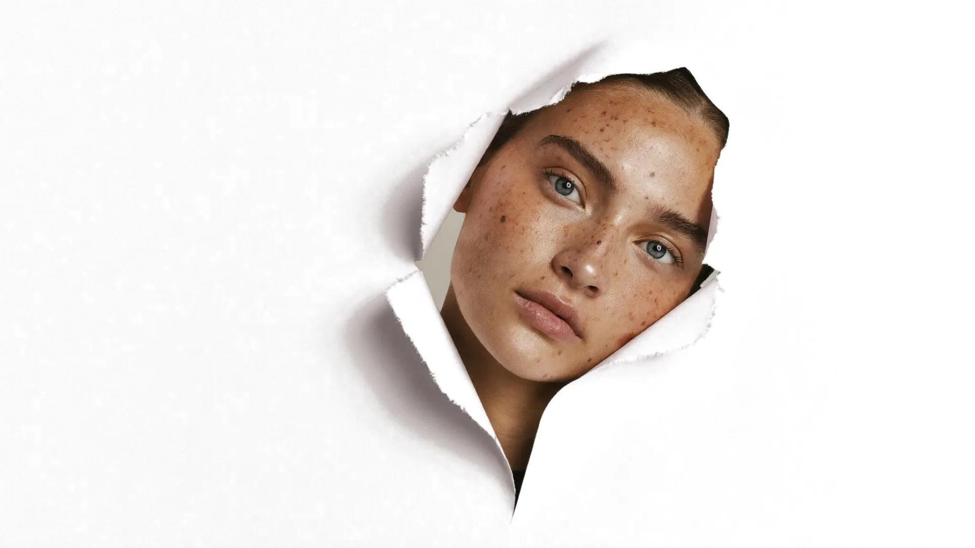 Porträt mit natürlichen Sommersprossen und ebenmäßiger Haut: Isabels Beauty Club München-Laim